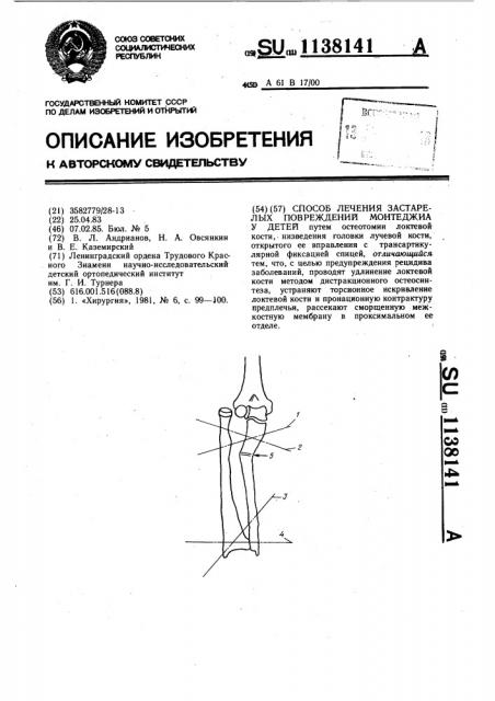 Способ лечения застарелых повреждений монтеджиа у детей (патент 1138141)