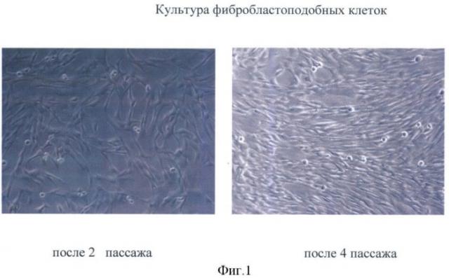 Способ получения фибробластоподобных клеток из пупочного канатика новорожденного (патент 2384618)