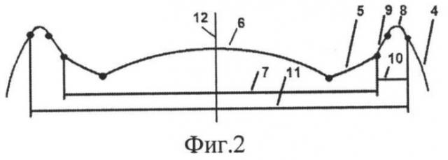 Способ хирургической коррекции пресбиопии в сочетании с простым миопическим астигматизмом (патент 2514877)