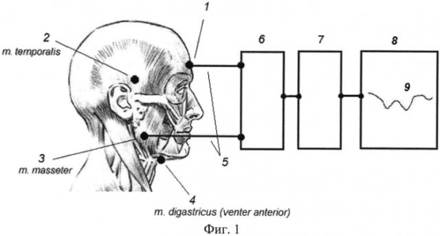 Способ регистрации моторной работы жевательной мускулатуры у человека (патент 2561332)