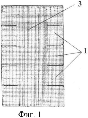 Способ пластики при послеоперационных вентральных грыжах (патент 2366367)