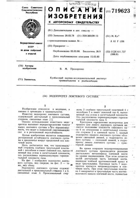 Эндопротез локтевого сустава (патент 719623)