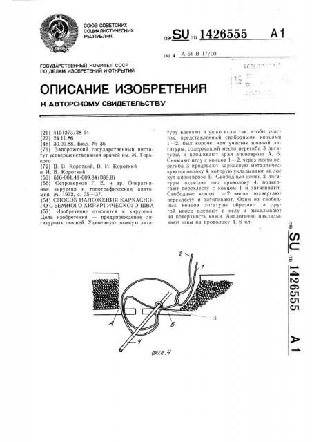 Способ наложения каркасного съемного хирургического шва (патент 1426555)