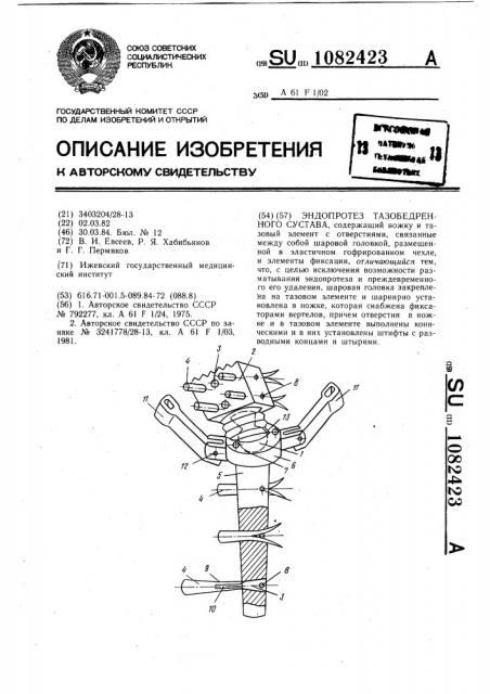 Эндопротез тазобедренного сустава (патент 1082423)