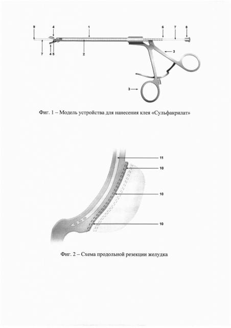 Устройство для доставки клея 