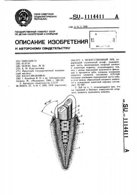 Искусственный зуб (патент 1114411)