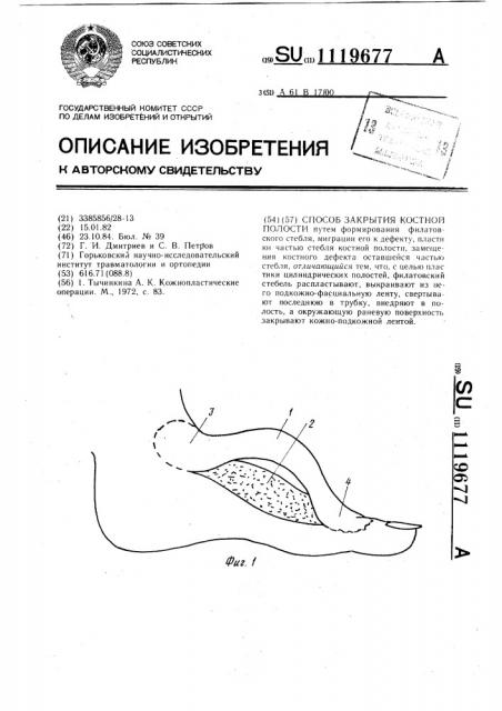 Способ закрытия костной полости (патент 1119677)