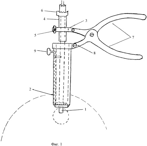 Способ малоинвазивного удаления опухолевых заболеваний молочной железы и устройство для его осуществления (патент 2394521)