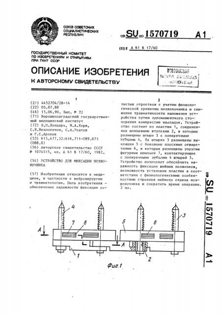 Устройство для фиксации позвоночника (патент 1570719)