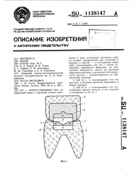 Искусственный зуб (патент 1138147)