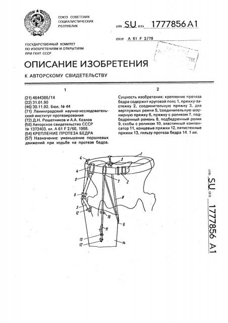 Крепление протеза бедра (патент 1777856)