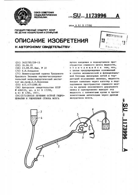 Способ лечения острой гидроцефалии и ущемления ствола мозга (патент 1173996)