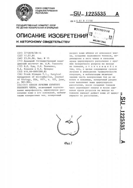 Способ лечения скрытого полового члена (патент 1225535)