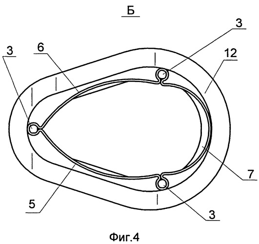 Протез трикуспидального клапана сердца (патент 2541043)