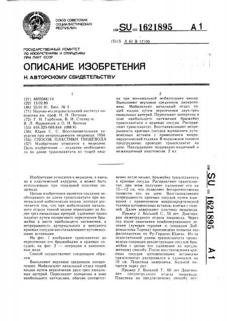 Способ пластики пищевода (патент 1621895)