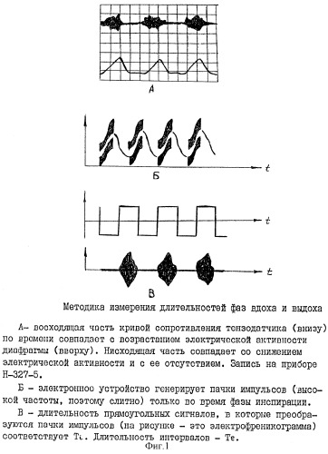 Способ ранней диагностики гипертонической болезни (патент 2313276)
