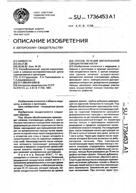 Способ лечения мягкотканной синдактилии кисти (патент 1736453)