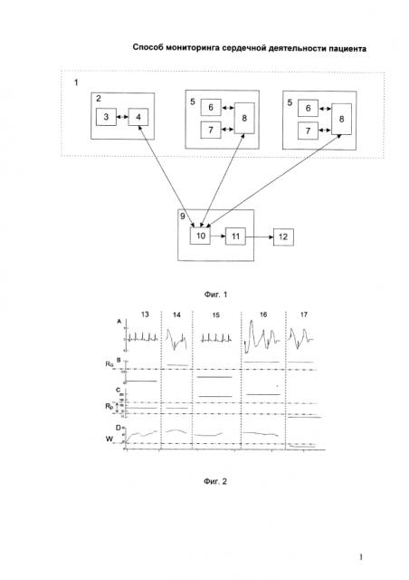 Способ мониторинга сердечной деятельности пациента (патент 2593351)