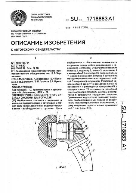 Эндопротез тазобедренного сустава системы д.м.гогуадзе (патент 1718883)