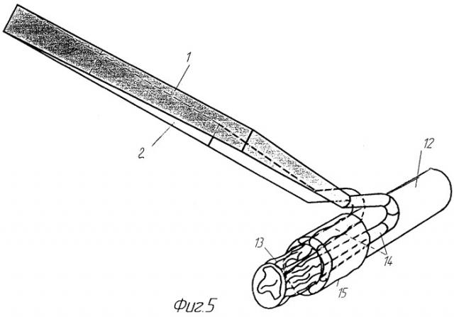 Хирургический инструмент для эндартерэктомии (патент 2407466)