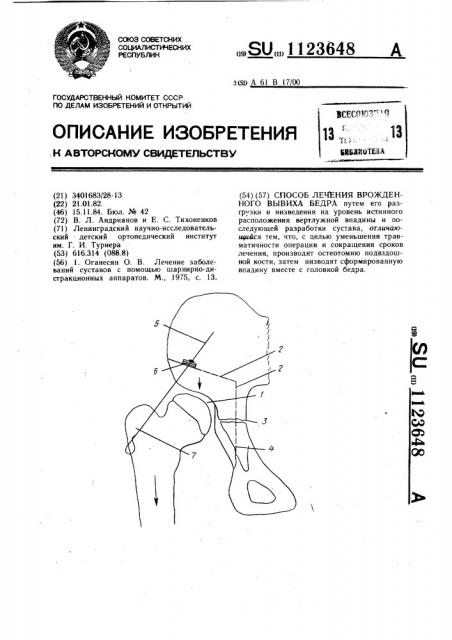 Способ лечения врожденного вывиха бедра (патент 1123648)