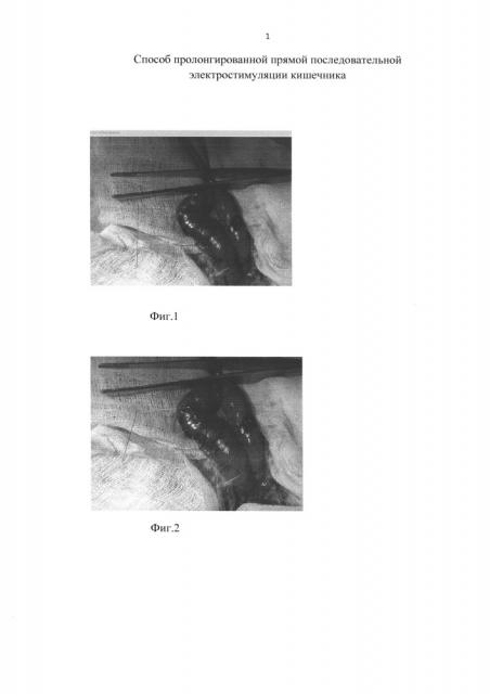 Способ пролонгированной прямой последовательной электростимуляции кишечника (патент 2619579)