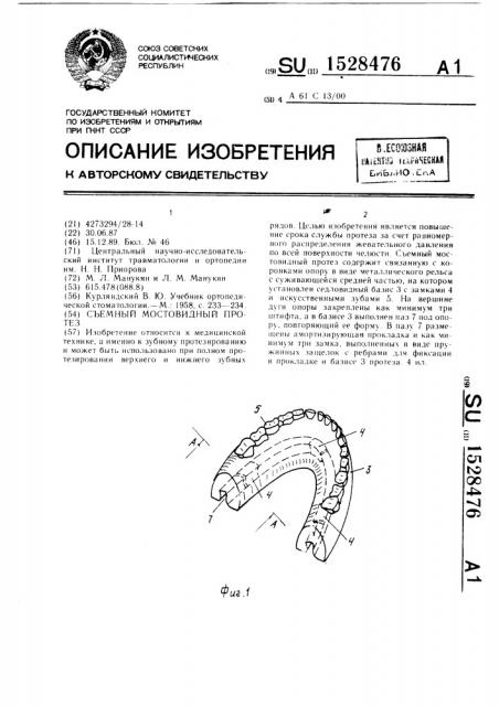Съемный мостовидный протез (патент 1528476)