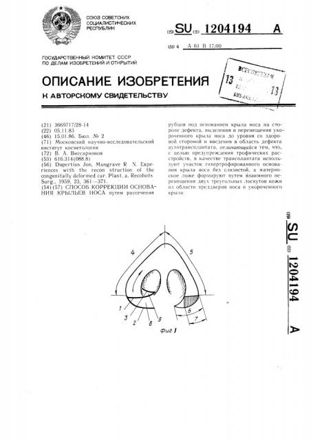 Способ коррекции основания крыльев носа (патент 1204194)