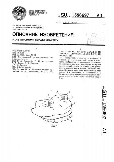 Устройство для замещения полного дефекта обеих верхних челюстей (патент 1586697)