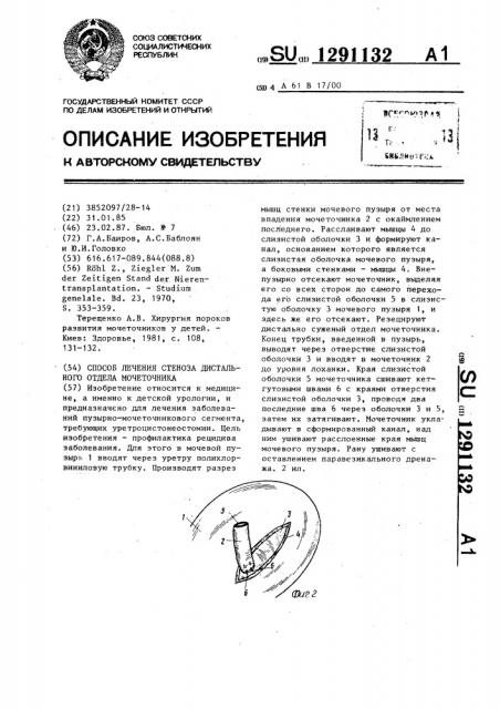 Способ лечения стеноза дистального отдела мочеточника (патент 1291132)