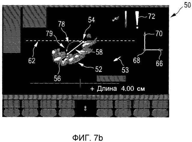 Система и способ трехмерных ультразвуковых измерений объемных областей (патент 2620865)