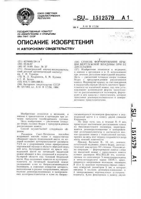 Способ формирования крыши вертлужной впадины при ее дисплазии (патент 1512579)