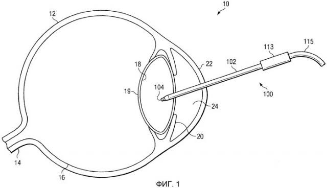 Наружный концевой пластиковый наконечник для введения/удаления (патент 2469685)
