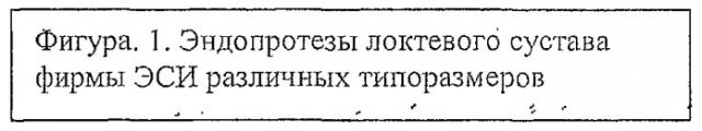 Способ лечения тяжелых внутрисуставных переломов локтевого сустава (патент 2463980)