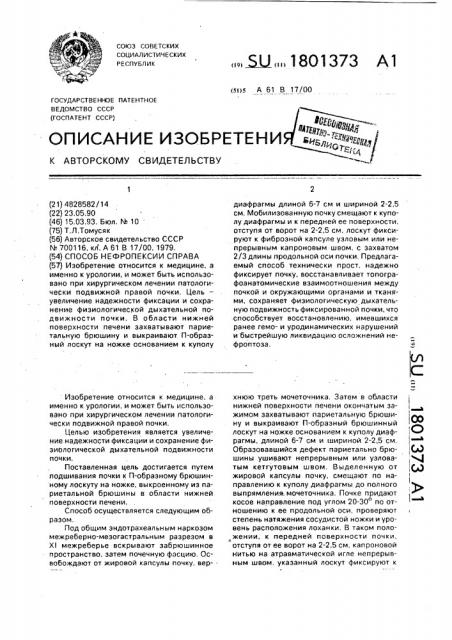 Способ нефропексии справа (патент 1801373)