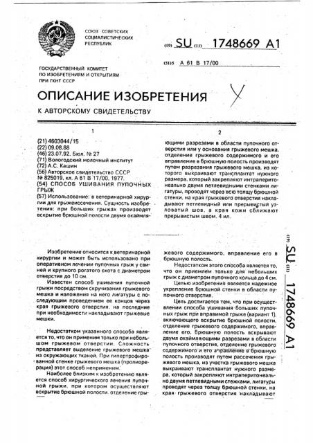 Способ ушивания пупочных грыж (патент 1748669)