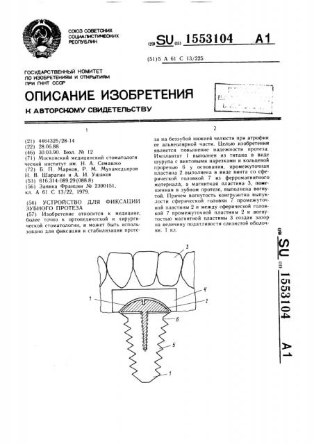 Устройство для фиксации зубного протеза (патент 1553104)