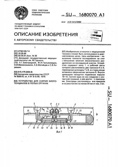 Устройство для снятия биопотенциалов в полых органах (патент 1680070)