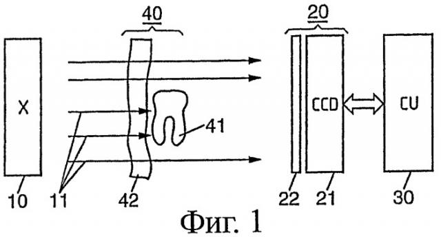 Регулирование положения подвижной рентгеноустановки (патент 2421138)