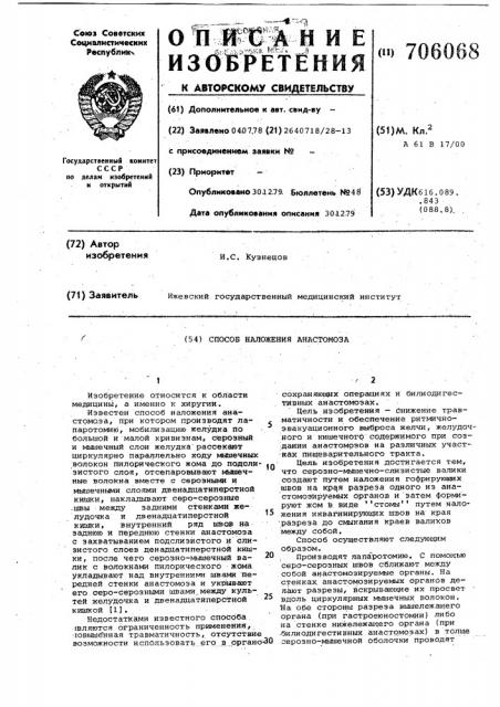 Способ наложения анастомоза (патент 706068)