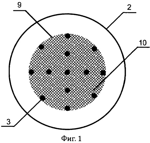 Способ увеличения размеров расщепленного экстрофированного мочевого пузыря при полнослойном дефекте и устройство для его осуществления (патент 2558980)