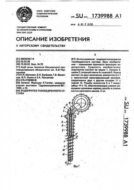 Эндопротез тазобедренного сустава (патент 1739988)