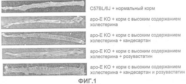 Терапевтическое лечение (патент 2358737)