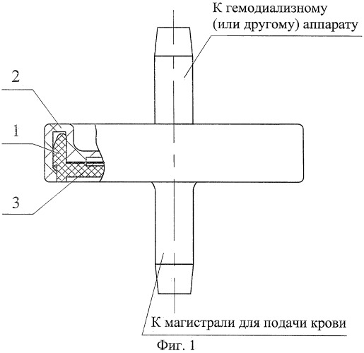 Разделительный фильтр для системы магистралей подачи крови (патент 2248811)