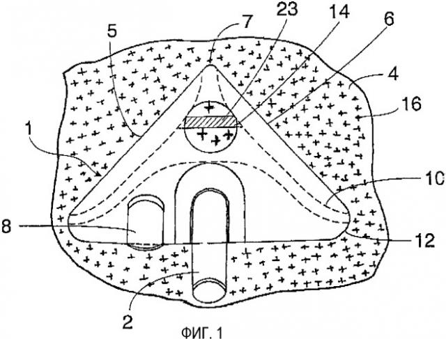 Всасывающее устройство пылесоса (патент 2328204)