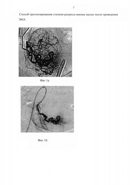 Способ прогнозирования степени регресса миомы матки (патент 2596093)