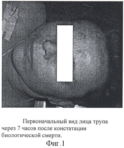 Способ восстановления естественной окраски кожи лица у трупов (патент 2411950)