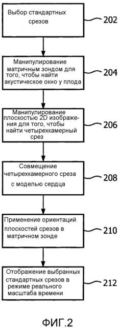 Автоматическое позиционирование стандартных плоскостей для оценки сердца плода в режиме реального времени (патент 2654611)