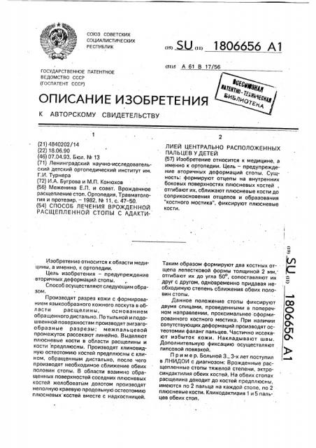 Способ лечения врожденной расщепленной стопы с адактилией центрально расположенных пальцев у детей (патент 1806656)