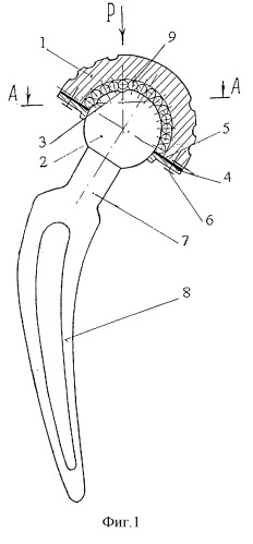 Эндопротез тазобедренного сустава (патент 2290137)